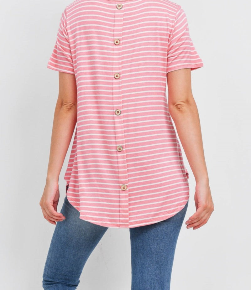Back Button Tunic Top